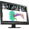Picture of EIZO RadiForce MX242W 2.3MP 61cm (24.1") Color LCD Monitor